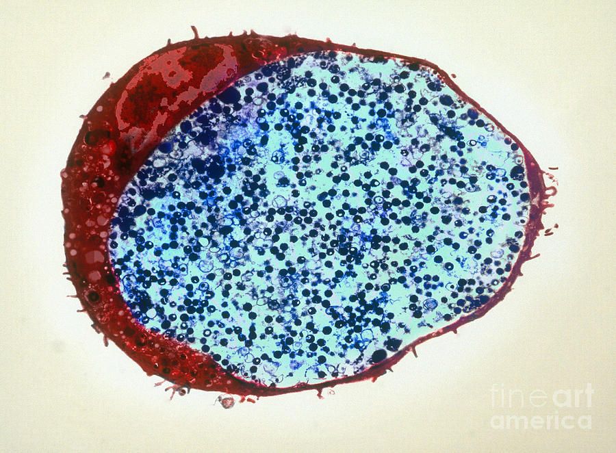 Microscopic view of Chlamydia