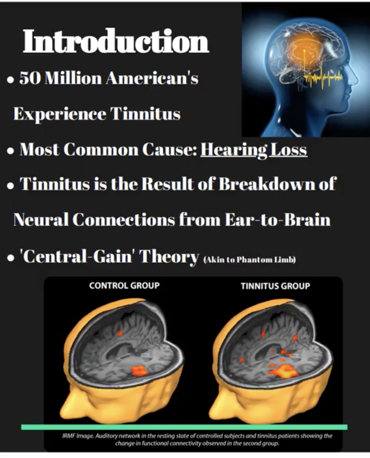 Introduction slide on CSD research featuring tinnitus brain graphics