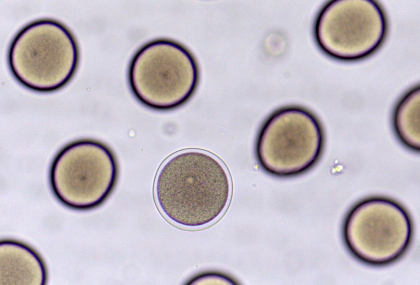 Sea Urchin eggs under a microscope