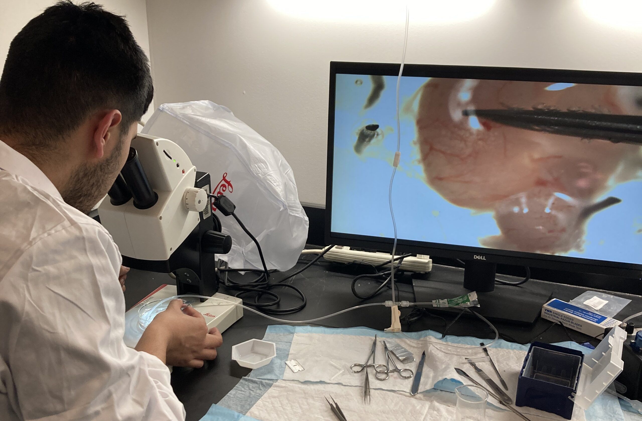 A person in a lab coat examines a specimen under a microscope, with the magnified image displayed on a monitor; surgical tools are arranged on the table.